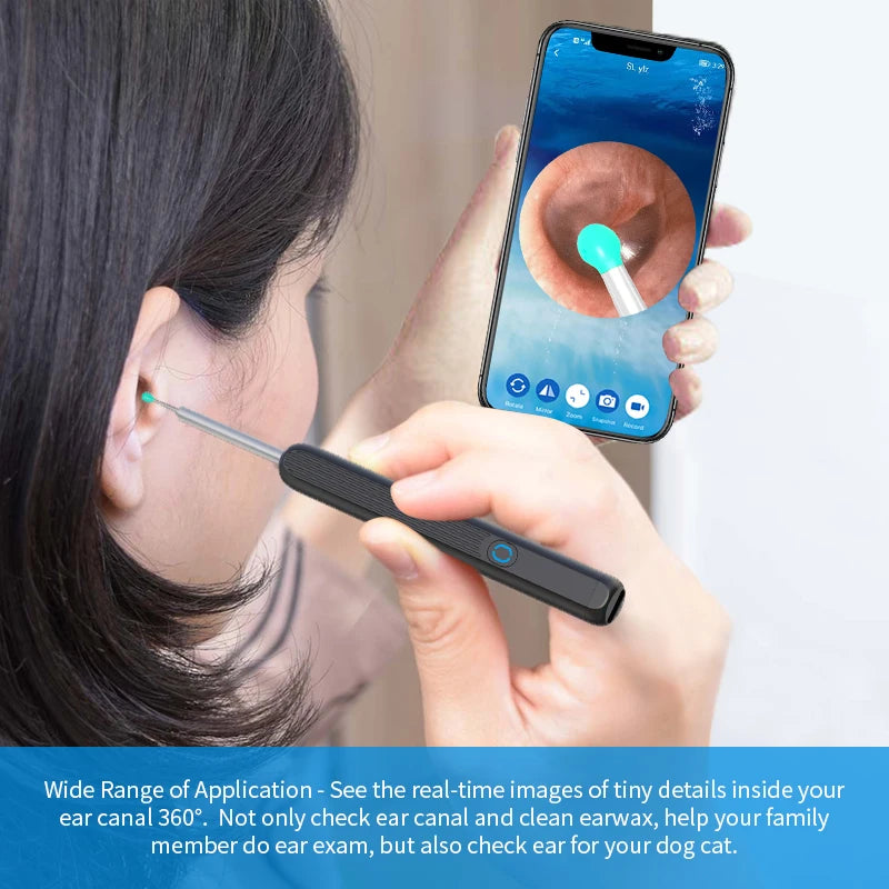 Neoclear Ear Crystal Clear View Smart Ear Explorer – Everything Flawless